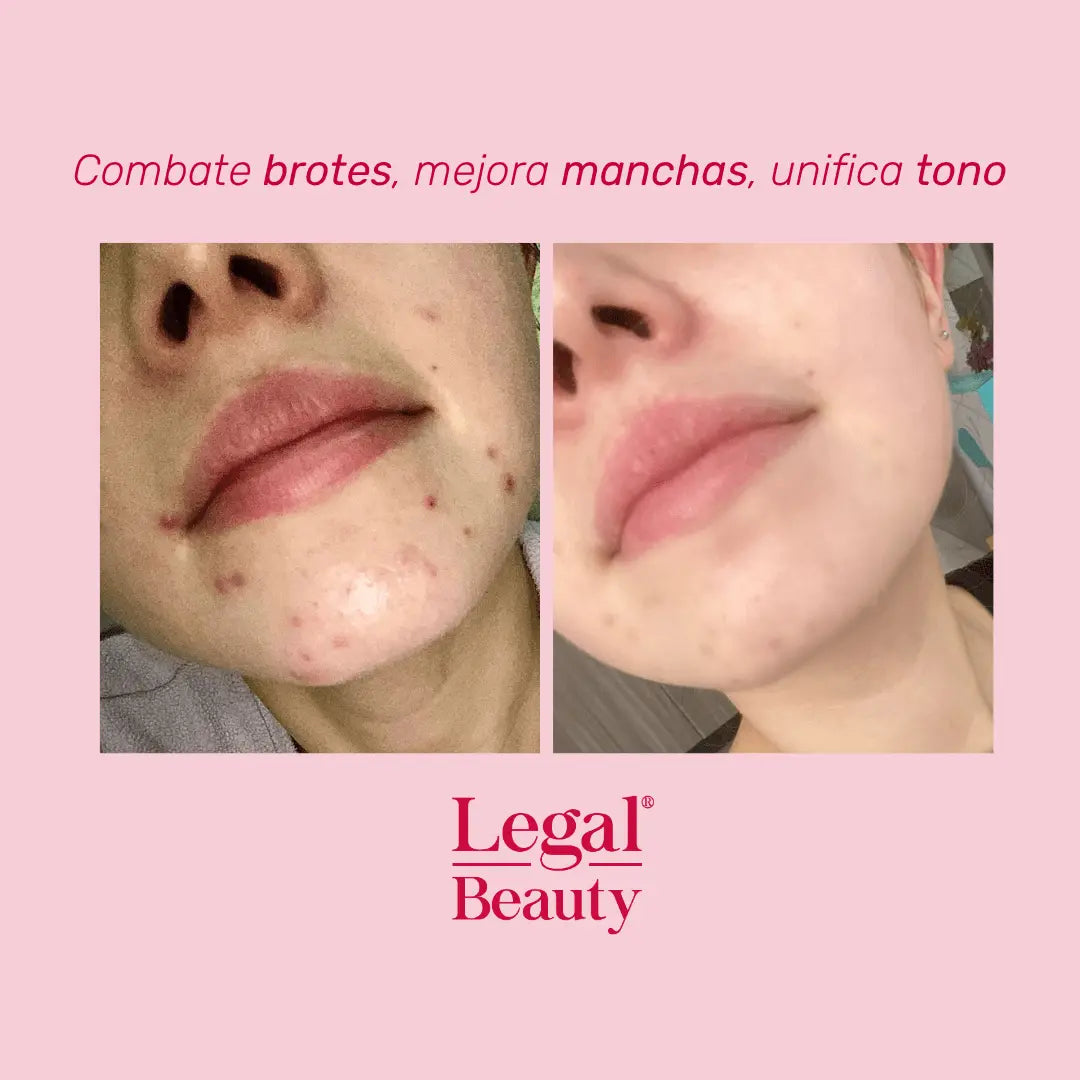 KIT+LIP+TOALLA