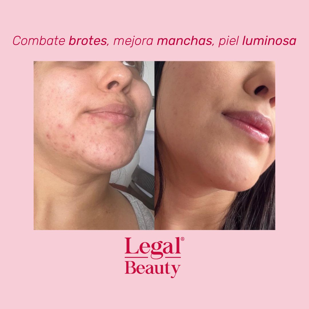 Glow Rescue serum niacinamida 10%
