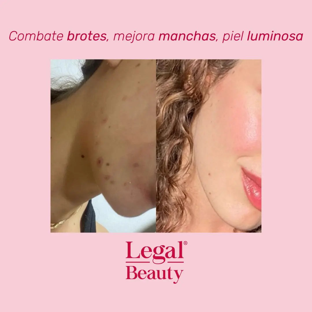 Kit Glow Essentials + Toalla desmaquillante