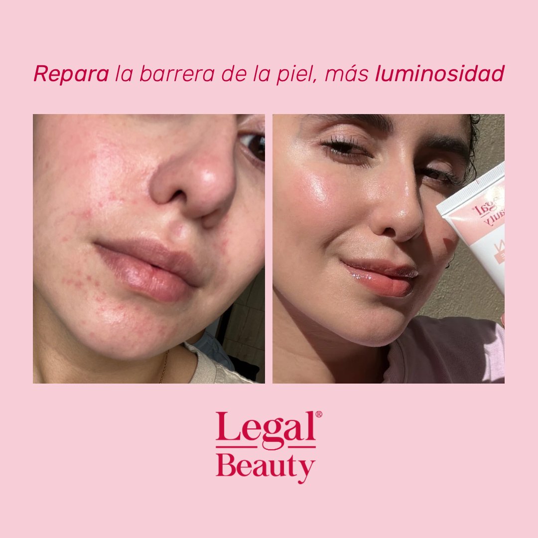 Skin Rescue crema hidratante reparadora