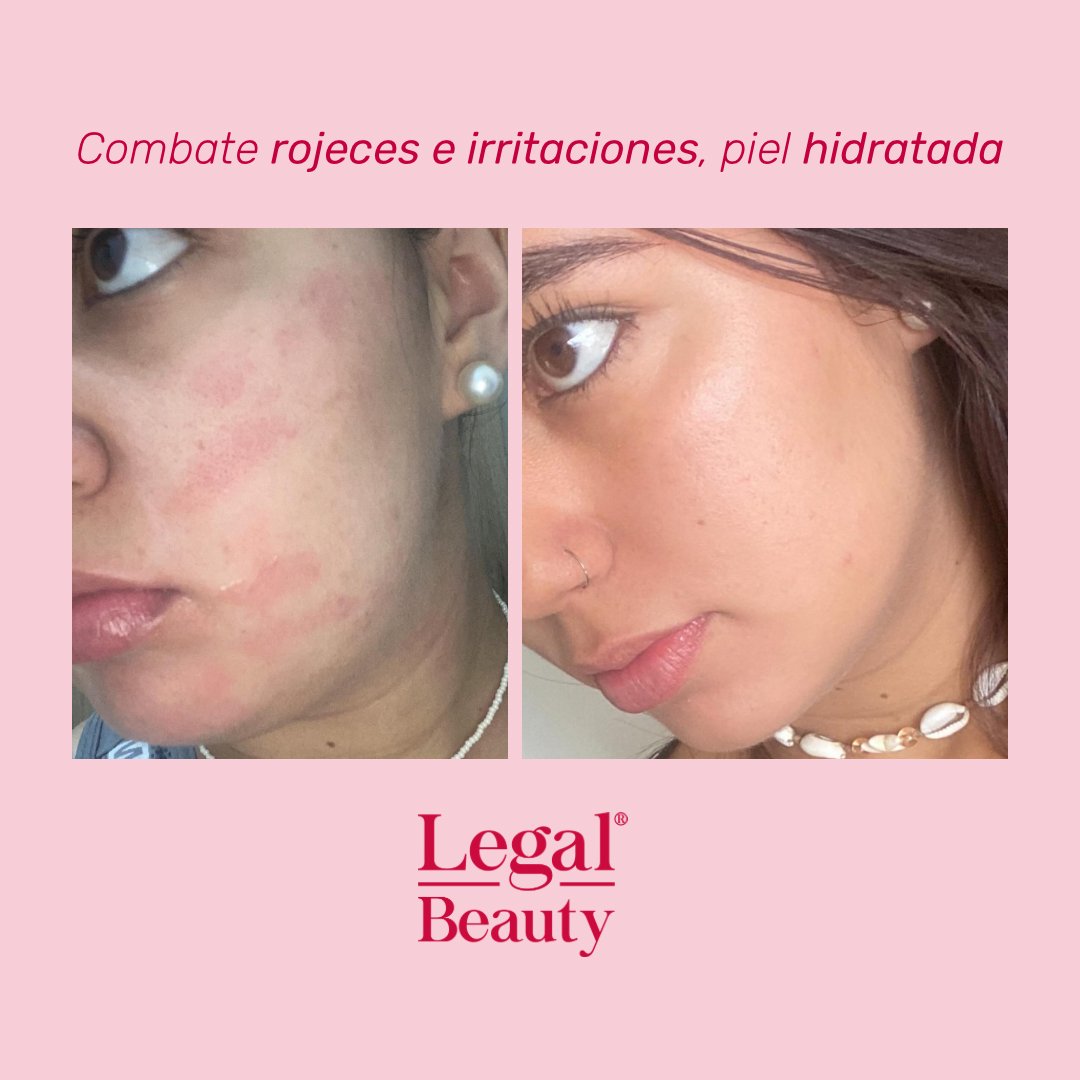 Skin Rescue crema hidratante reparadora