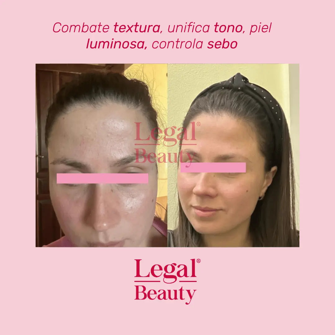 KIT+LIP+TOALLA